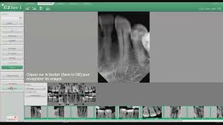 Vatech EzDent i  TUTORIEL ACQUISITION Onglet 02   Acquisition capteur intraoral SYNERGY DENTAL