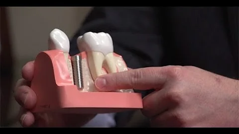 Same Day Dental Implant Procedure with Oral Surgeon Dr. John Wallace