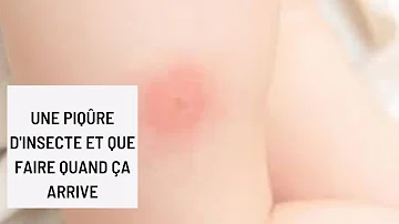 Quelle piqûre d'insecte provoque des cloques ?