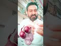 Benefits of Eating Raw Onion Daily ● Onion for Cholesterol & BP ● #youtube