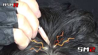 【眠れるアトピー性皮膚炎ASMR】超痒い頭皮を鉛筆（HB）で掻く音/癒し/リラックス効果/睡眠導入/マッサージ