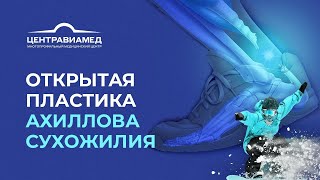 Открытая пластика ахиллова сухожилия