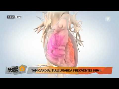 Video: Tahicardie Sinusală A Inimii - Ce Este? Ce Sa Fac?
