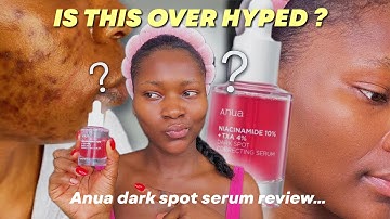 ANUA DARK SPOT CORRECTING SERUM REVIEW | Does it actually work + How to properly use #darkspots
