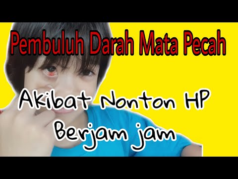 Video: Telefon bimbit berbahaya bagi mata