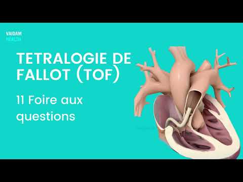 Vidéo: A tétralogie de fallot ?