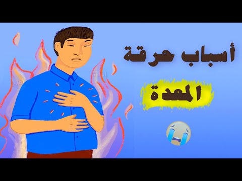 أسباب حرقة المعدة