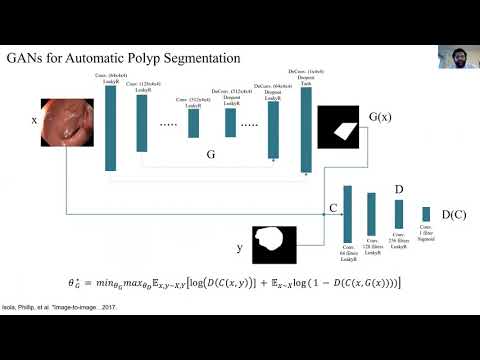 Generative Adversarial Networks for Automatic Polyp Segmentation