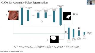 Famous Generative Adversarial Networks for Automatic Polyp Segmentation Net Worth