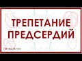 Трепетание предсердий