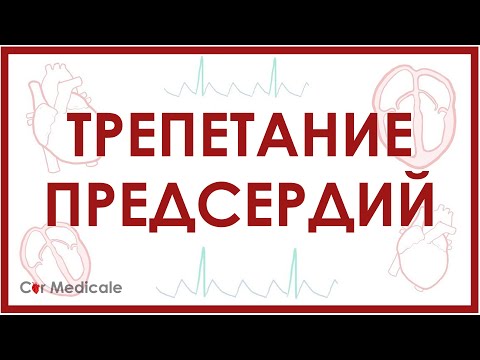 Трепетание предсердий