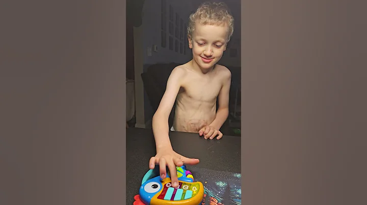 Lucas taught himself how to play Twinkle Twinkle Little Star #Omphalceleawareness #autism