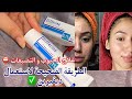 Différine علاج حب الشباب نصائح مهمة قبل استخدام كريم او جيل ديفرين لازالة الحبوب و النذوب نتيجة Différine علاج حب الشباب نصائح مهمة قبل استخدام كريم او جيل ديفرين لازالة الحبوب و النذوب نتيجة