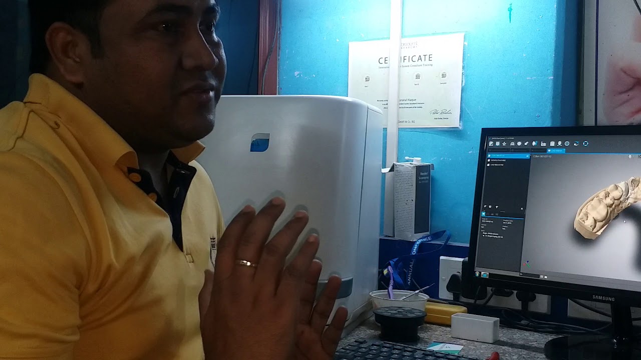 CAD-CAM SCANNING PROCESS PART-2 - YouTube