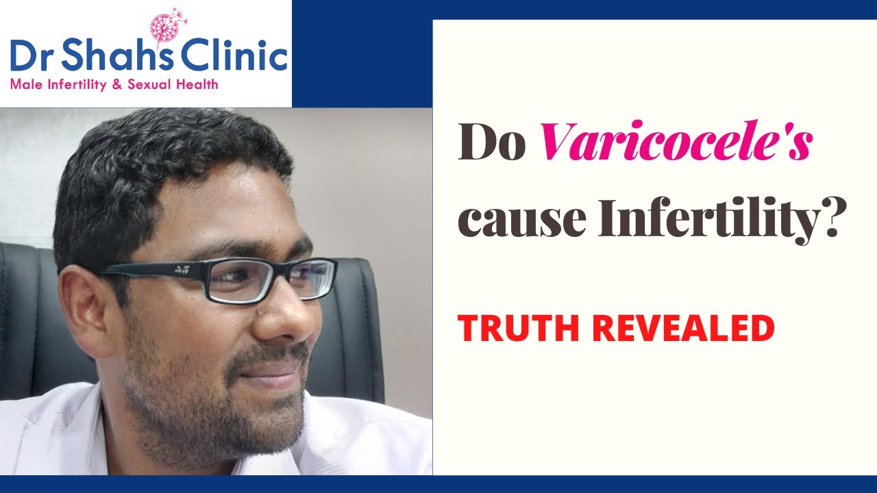 Do varicoceles cause infertility? Shocking facts revealed