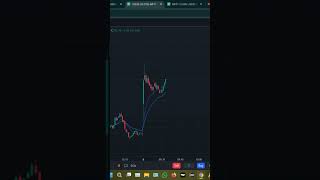 Stock trading vs Option trading 2026,Day - 25 #tradingbasics #tradingforbeginners