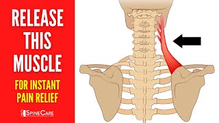 Download Lagu The #1 Muscle to Release to Fix Your Neck Pain MP3 Download Lagu The #1 Muscle to Release to Fix Your Neck Pain MP3