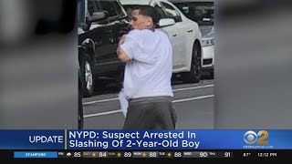 Suspect In Apparently Random Slashing Of 2-Year-Old In Custody