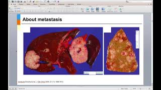 HOPP Summer Research Seminar Series: Cancer Metastases w/ Alvin Makohon-Moore, PhD