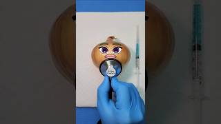 Vegetable onion surgery Short Story #fruitfix #fruit #funny #fruitstories #fruitcutting