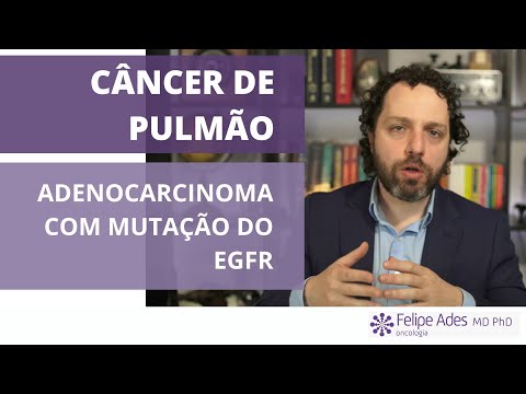 Vídeo: Análise Da Textura Por TC Do Adenocarcinoma De Pulmão: Os Recursos Radiômicos Podem Ser Biomarcadores Substitutos Para Os Status De Mutação Do EGFR