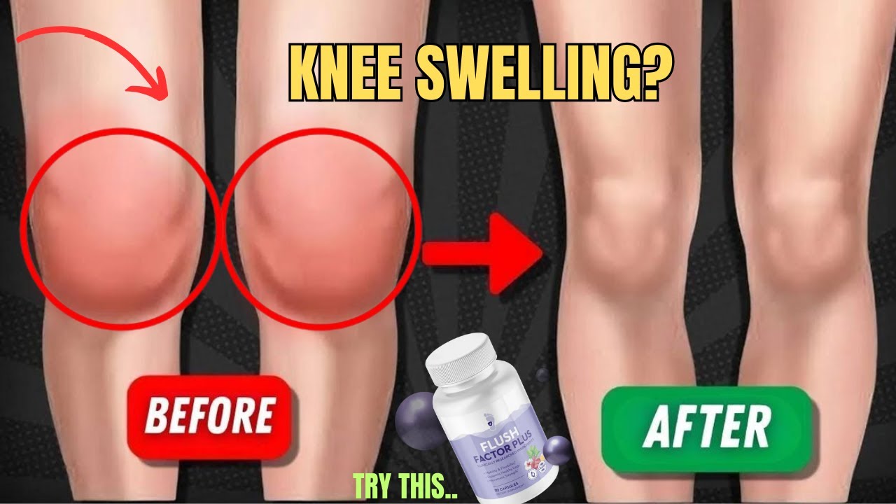 Flush Factor Plus Review ((⛔MUST WATCH⛔) Your Immunity Shield in a Bottle 🛡️💊