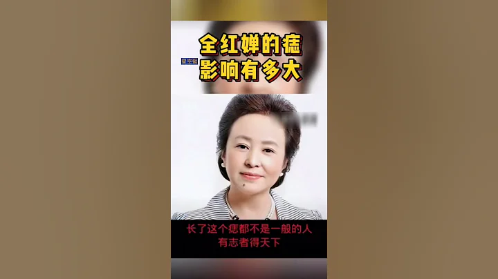 全红婵美人痣#长了这个痣都不是一般的人 - 天天要闻