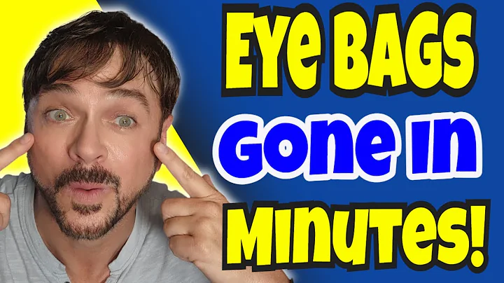 3 QUICK Under Eye Bag Fixes (Dark Circles Too!) | Chris Gibson