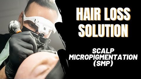 Scalp Micropigmentation Video