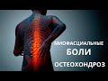 Миофасциальные боли и остеохондроз