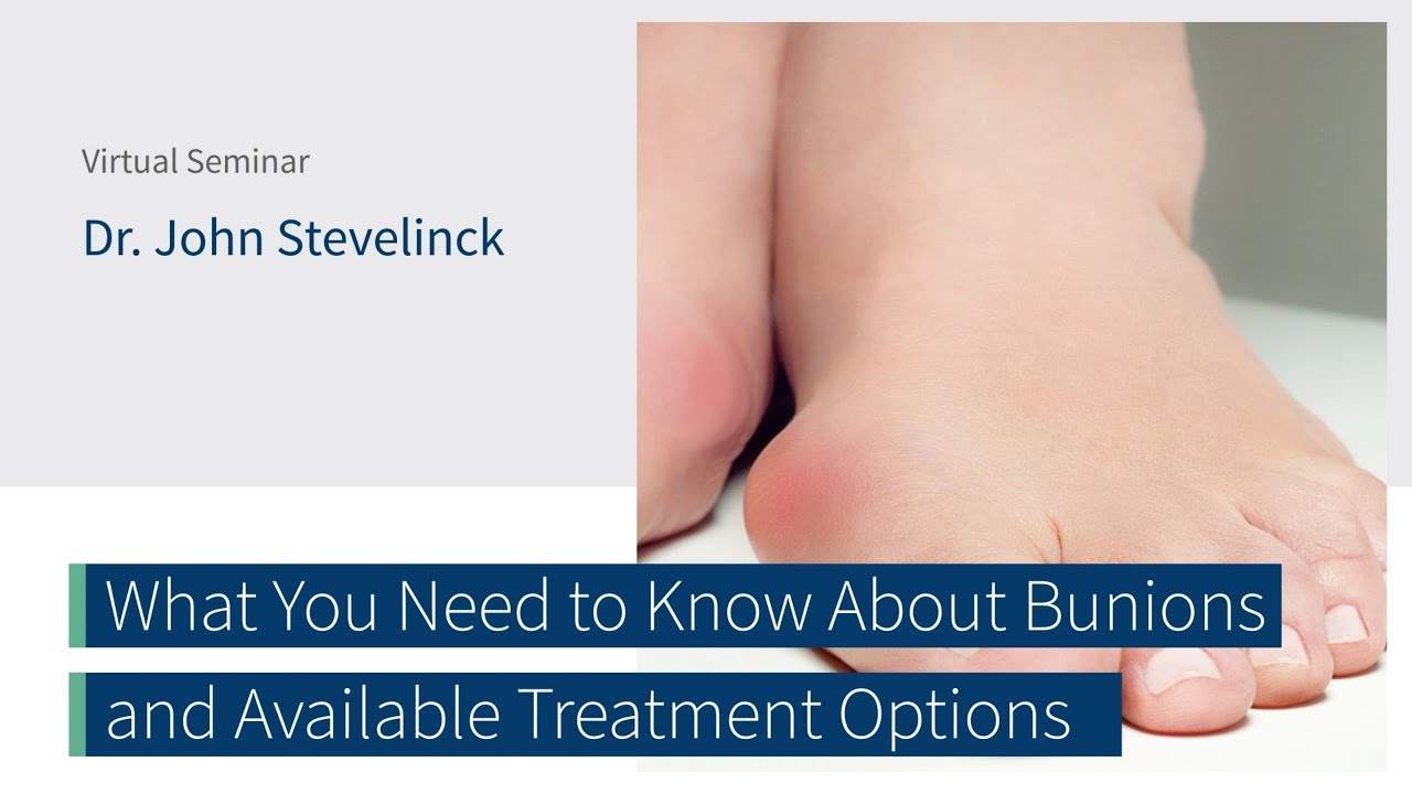 What You Need to Know About Bunions & Treatment Options w/ Dr. John Stevelinck | The CORE Institute