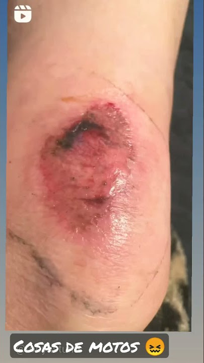 cosas de #motos #caidas #moto #accidente #593 #motovlog #rider #cuidado #short #popular