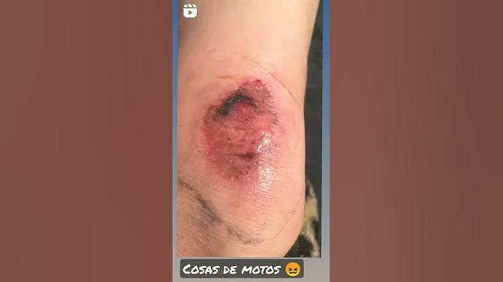 cosas de #motos #caidas #moto #accidente #593 #motovlog #rider #cuidado #short #popular