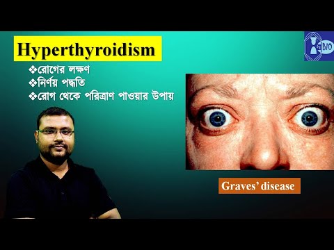 Hyperthyroidism in Bengali I Causes,Diagnosis,Treatment I Graves’ Disease