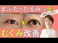 【毎日5分】目を大きくしたい人へ！まぶたのたるみ・むくみ改善の顔トレ