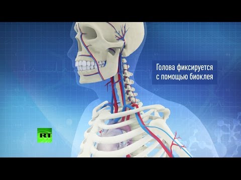 Видео: Серджо Канаверо: „Трансплантацията на глава ще се осъществи през г., а мозъчната трансплантация през г.“- Алтернативен изглед