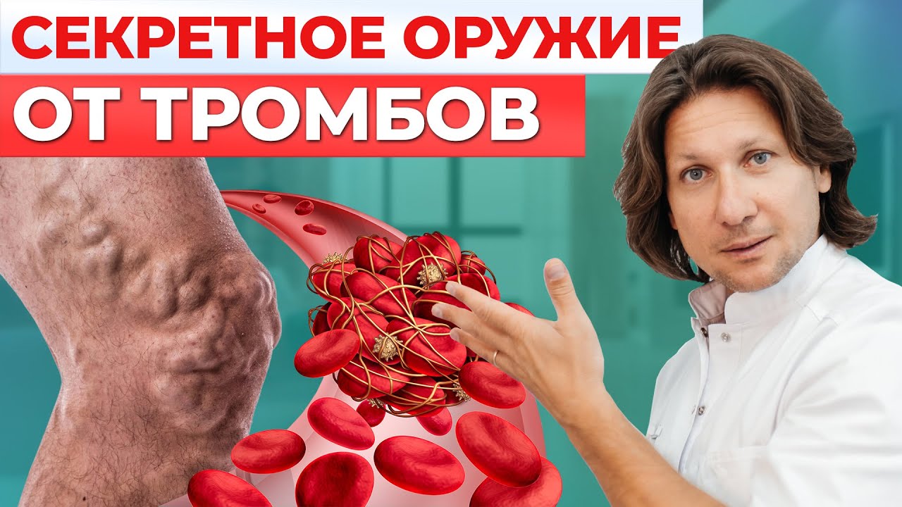 Как сохранить ВЕНЫ в хорошем состоянии? / Как НЕ ДОПУСТИТЬ образование ...