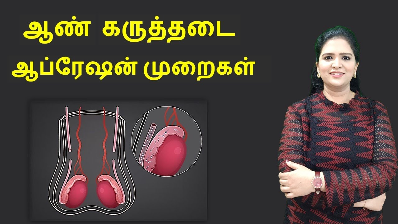 Vasectomy Male Sterilization Tamil YouTube