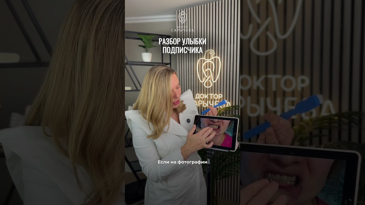 Подбородок мешает улыбаться. Дистальный глубокий прикус.В шапке профиля- онлайн диагностика прикуса