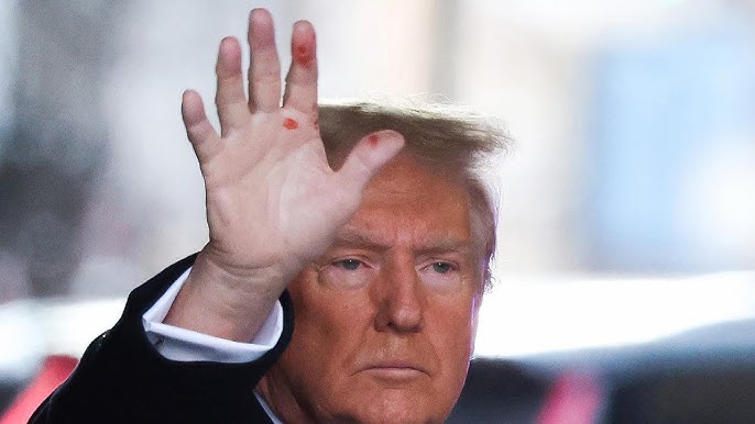 What Are The Mysterious Red Marks On Donald Trump S Hand