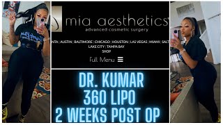 MIA AESTHETICS BALTIMORE || 360 LIPO || 2 WEEKS POST OP