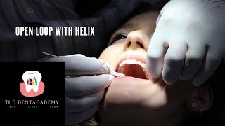 open loop with helix