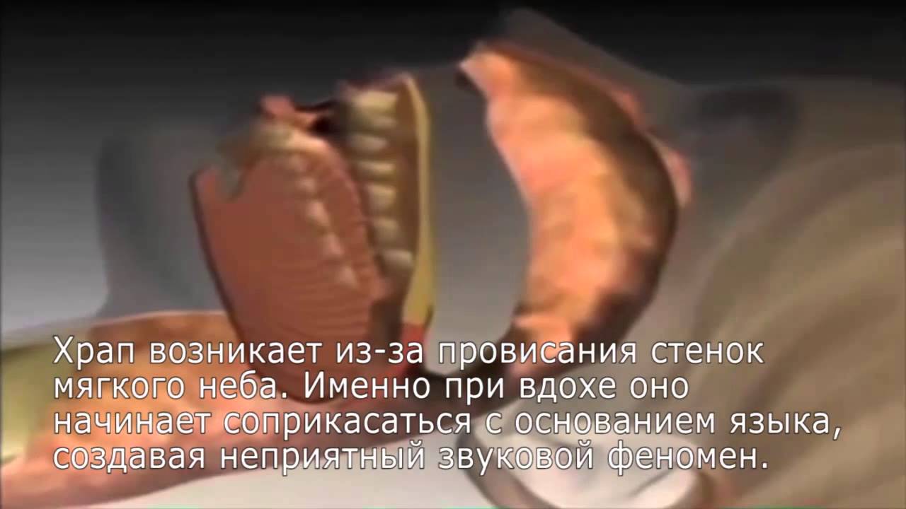 Причины возникновения храпа у детей во сне