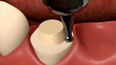 Fixed Bridge Animation