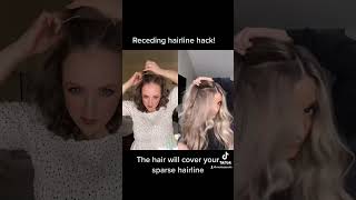 Receding hairline hack, half up hack with ​⁠​⁠@alexamcmanaman #hairhack #halfuphalfdown #hair