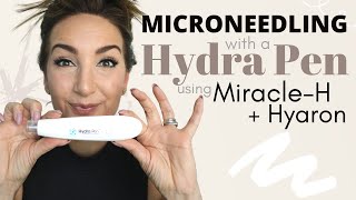 MICRONEEDLING WITH A HYDRA PEN USING MIRACLE-H + HYARON