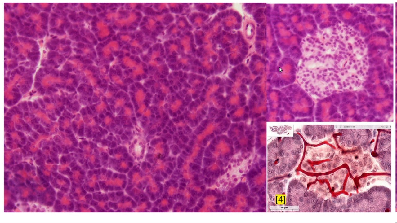 Препарат железа печень. Островки Лангерганса гистология препарат. Поджелудочная железа гистология препарат. Срез поджелудочной железы гистология. Панкреатический островок гистология.