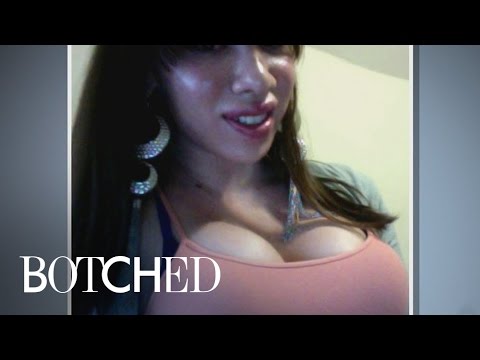 Removing Breast Implants Does What to Nipples?! | Botched | E!