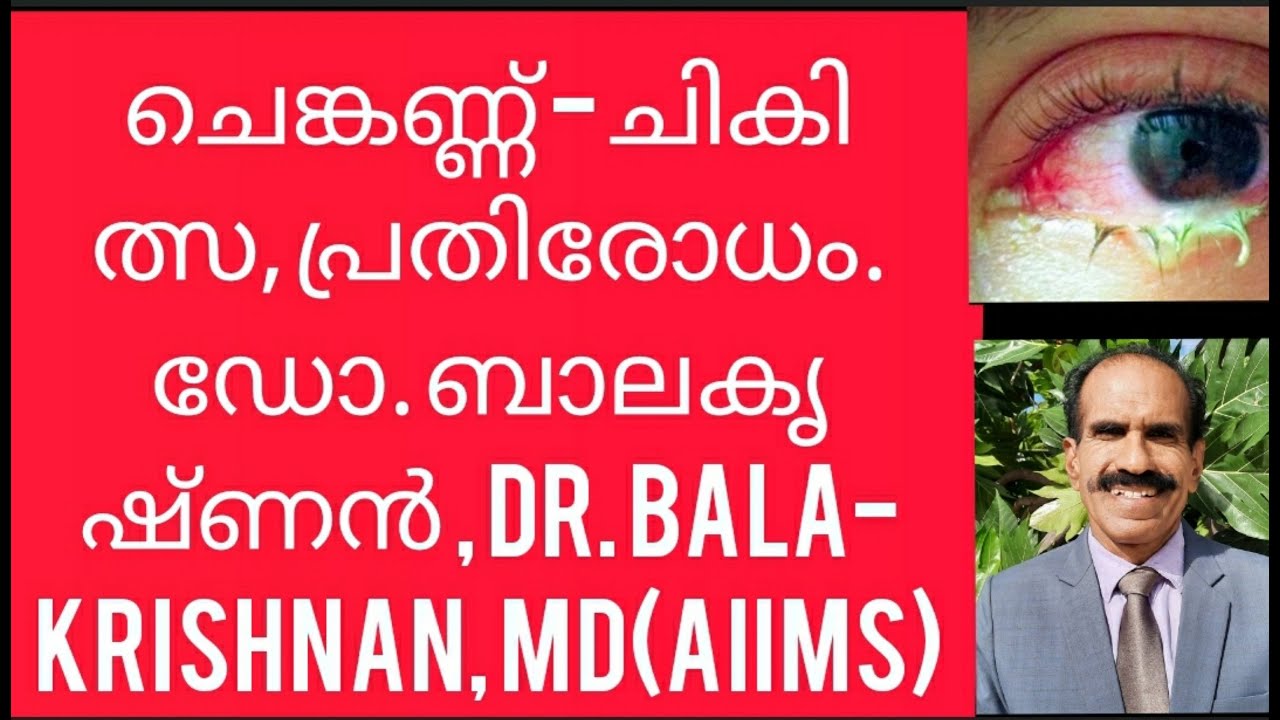 RED EYESTREATMENT.ചെങ്കണ്ണ് ചികിത്സ, പ്രതിരോധം. ഡോ.ബാലകൃഷ്ണൻ,MDAllMS. DR.BALAKRISHNAN
