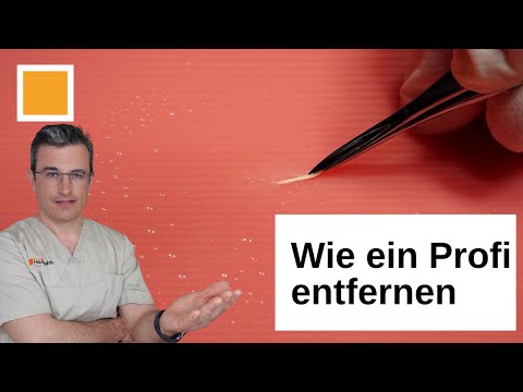 Video: Wie entferne ich Splitter?